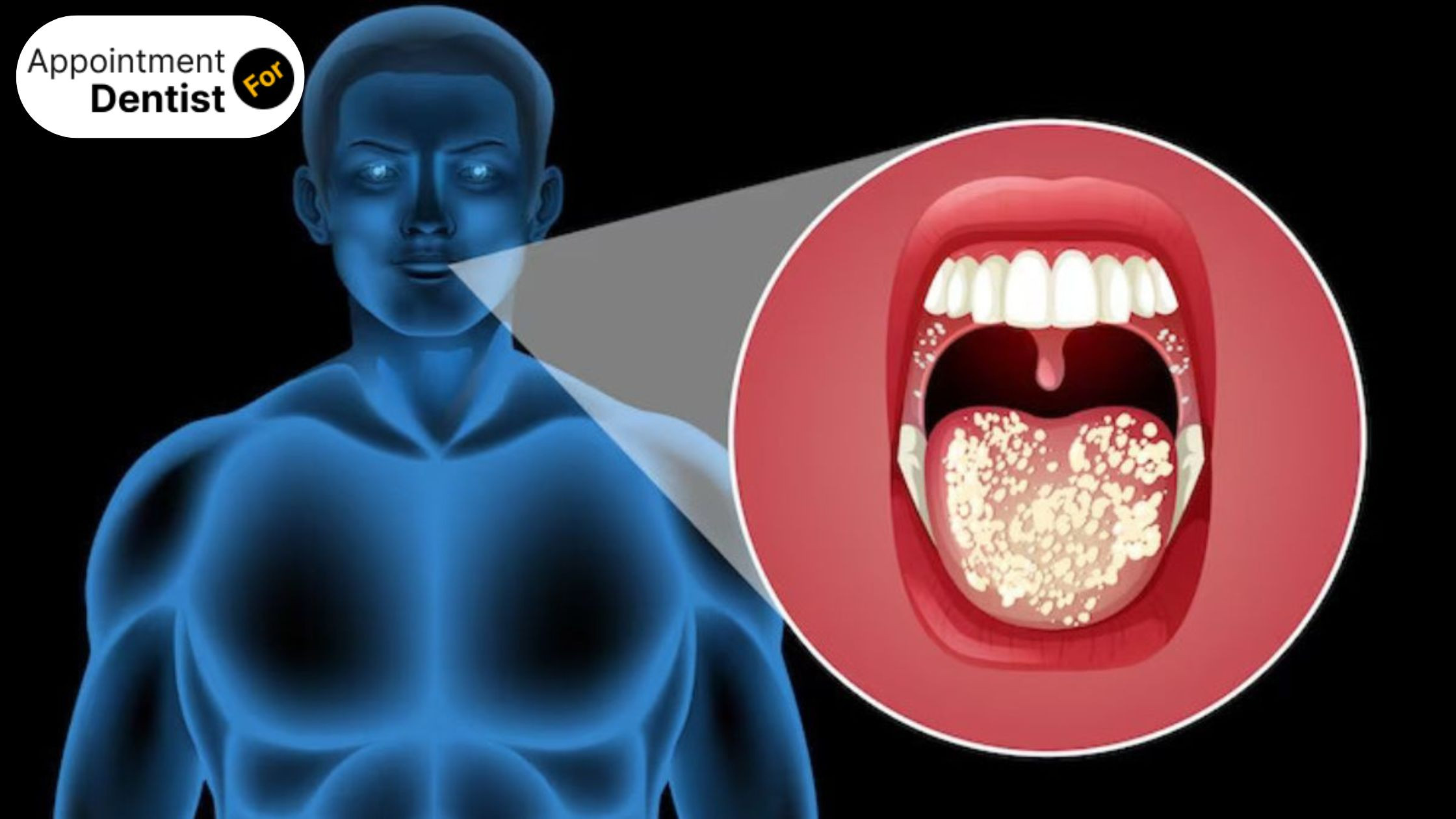 Understanding and Treating Oral Cancer: Early Detection Saves Lives