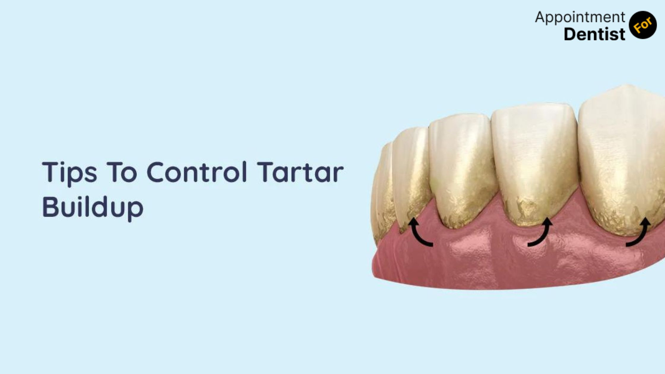 Addressing and Managing Tartar Buildup: Effective Techniques