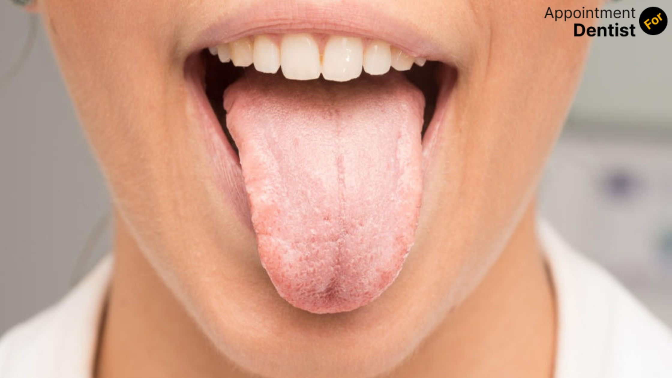 Understanding and Treating Leukoplakia