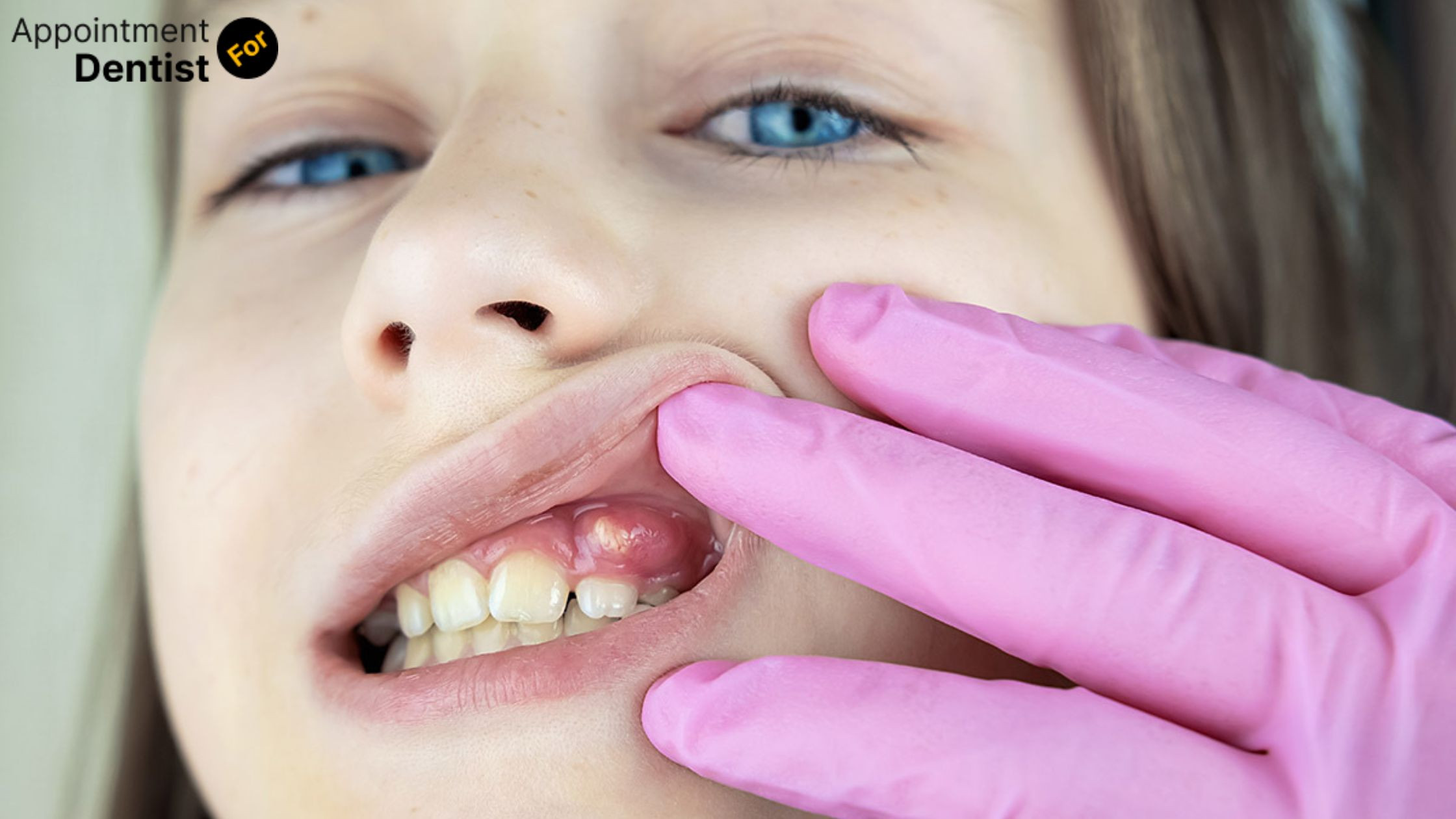 Dealing with and Preventing Dental Fistulas