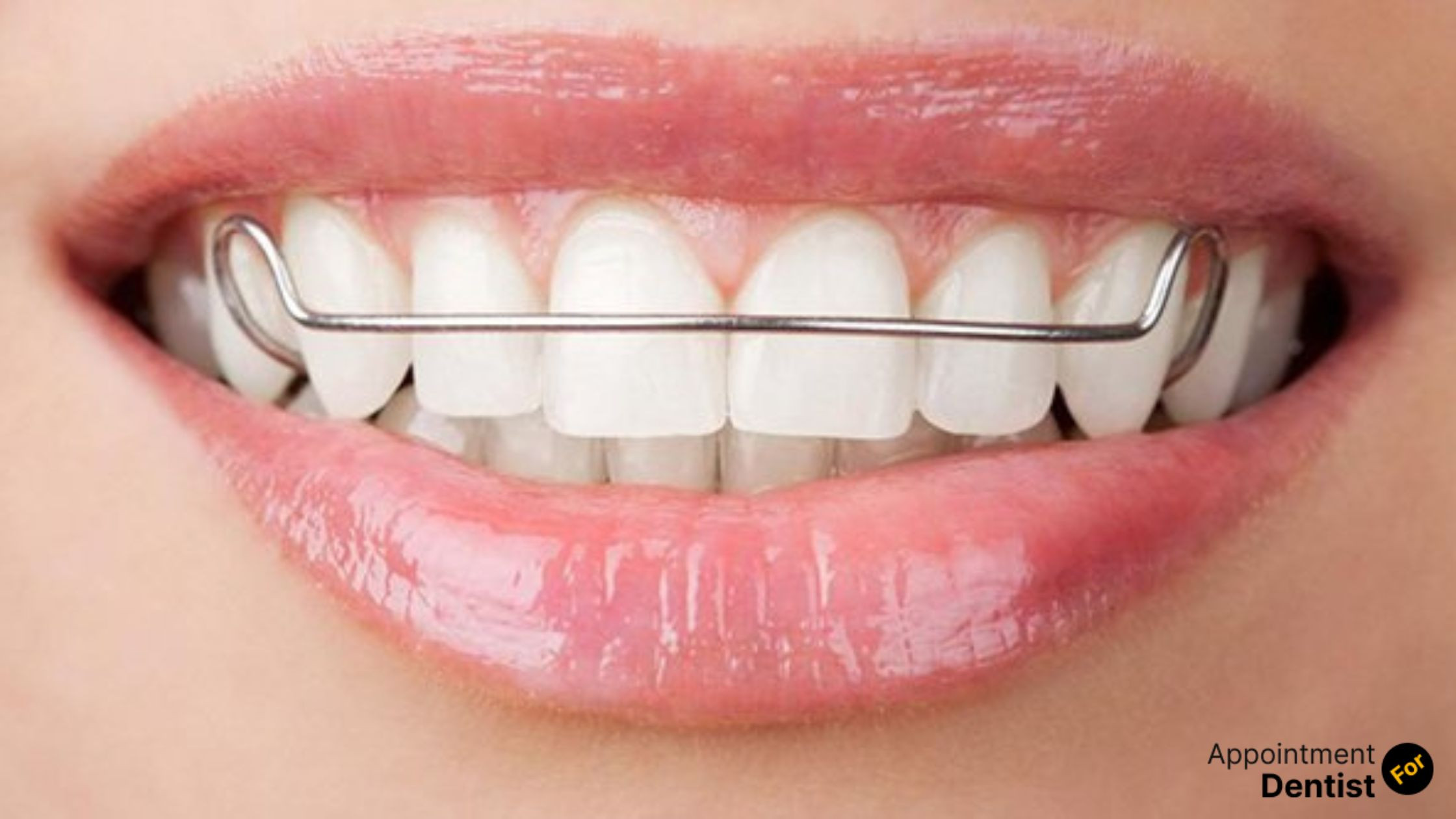 Understanding the Different Types of Orthodontic Treatments